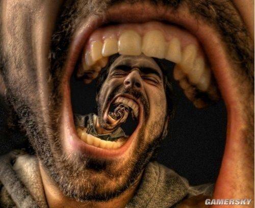 单纯性恐惧症
