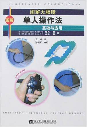 图解大肠镜单人操作法