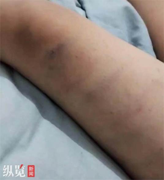 10·13恩施小学生遭老师体罚事件