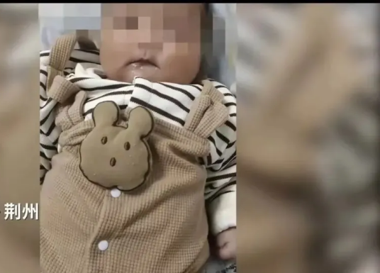 10·4荆州男婴接种疫苗后死亡事件