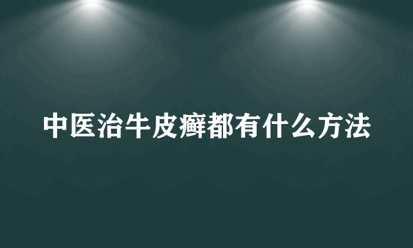 中医治牛皮癣都有什么方法