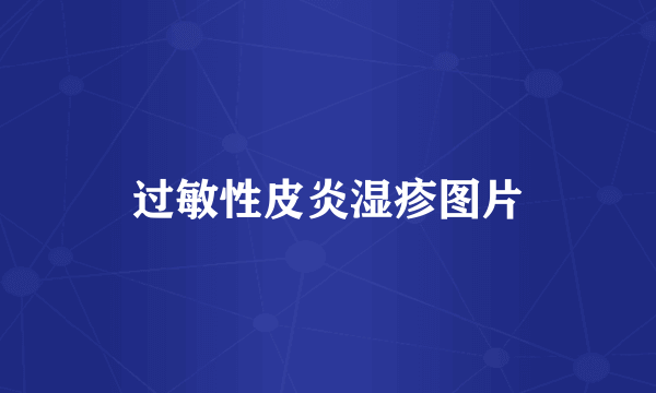 过敏性皮炎湿疹图片